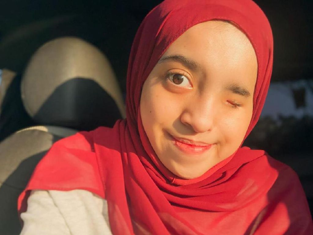 Kisah Viral Hijabers Medan Alami Skoliosis: Mata dan Wajah Aku Tak Simetris Kisah Viral Hijabers Medan Alami Skoliosis: Mata dan Wajah Aku Tak Simetris