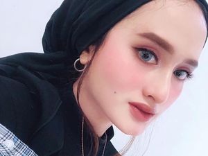 Foto Selebgram Aceh Cantik yang Kembali Ditaksir Mantan Setelah Turun 30 Kg