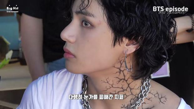 Pelipis V BTS dihantam ritsleting