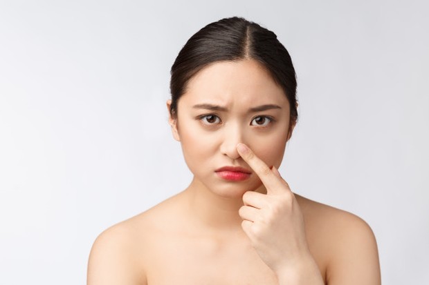 Flek hitam yang muncul merupakan salah satu tanda penuaan yang terjadi di usia 20 an