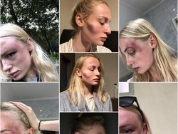 Kisah Model Hampir Mati Dipukuli Pacar, Awalnya Merasa Dia Sosok Sempurna