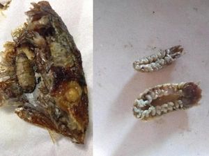 Ngeri! Wanita Ini Temukan Kutu Pemakan Lidah saat Makan Ikan