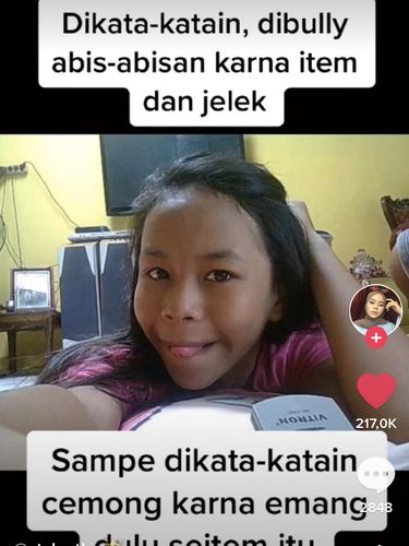 Kisah Giseliane Sekartadzi yang dulunya berkulit gelap kini berhasil glow up