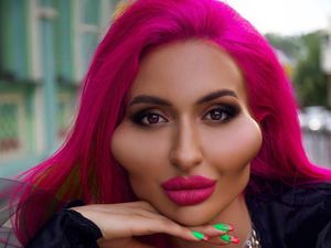 Modifikasi Pipi Ekstrem, Selebgram Ini Ingin Punya Pipi Terbesar di Dunia Modifikasi Pipi Ekstrem, Selebgram Ini Ingin Punya Pipi Terbesar di Dunia