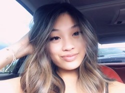 Wanita 19 Tahun Meninggal Setelah 14 Bulan Koma karena Operasi Payudara