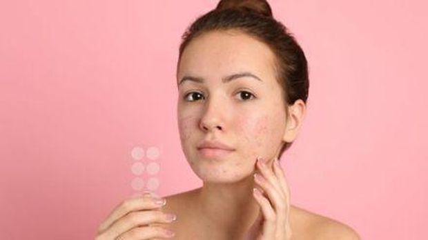 Ilustrasi jerawat batu/id.pinterest.com