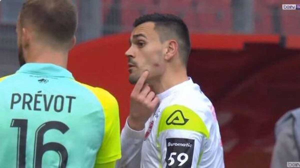 Kiper Valenciennes Jerome Prior menunjukkan pipinya yang disebutnya digigit lawan. (Foto: Twitter @screenshor beIN Sports)