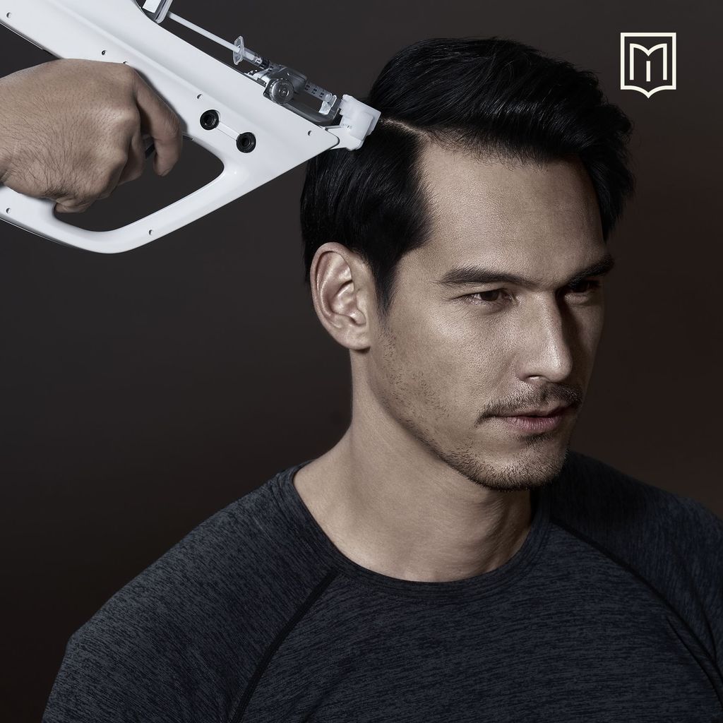 Treatment PRP di Zap untuk rambut rontok