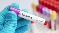 Infeksi Norovirus Mewabah di Kapal Pesiar Ambition, Prancis Isolasi Penumpang
