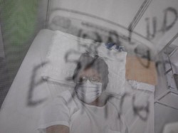 Yuk Kenali Lagi Beda Gejala DBD dan COVID-19