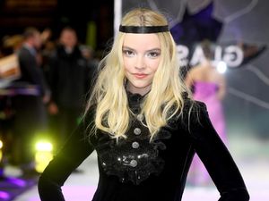 Potret Imut Anya Taylor-Joy, Si Queens Gambit