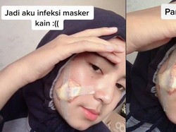 Viral Kisah Wanita Berjerawat Karena Masker Kain, Akhirnya Sampai Dioperasi