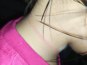 Anaknya Hampir Tewas karena Main TikTok, Ibu Ini Beri Peringatan di Medsos