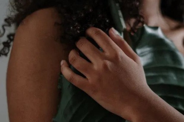 memilih ukuran bra ilustrasi: salah memilih ukuran bra dapat menyebabkan kulit lecet