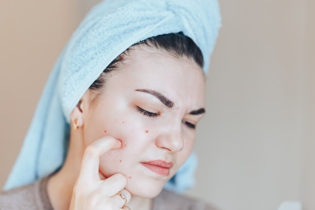 Perawatan Wajah/ Sumber: Freepik.com Produk dengan vitamin C dapat mencerahkan pigmen di bawah mata. Tetapi ini tidak akan menghilangkan lingkaran hitam dari pembuluh darah yang terlihat.