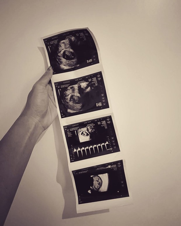 Audi Marissa hamil anak pertama