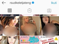 Akun Medsos RSUD Kelet Jepara Di-hack, Tampilkan Foto-foto Syur Wanita