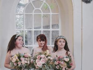 Nasib Sedih Wanita Berwajah Rusak karena Dimakan Bakteri Pemakan Daging