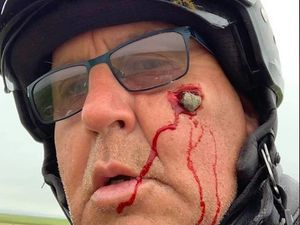 Ngilu! Batu Kerikil Tembus ke Pipi, Ini Alasan Pentingnya Pakai Helm Full Face