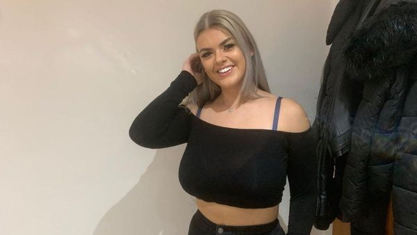 Derita Wanita Berukuran Bra I, Buka Donasi Agar Bisa Kecilkan Payudara