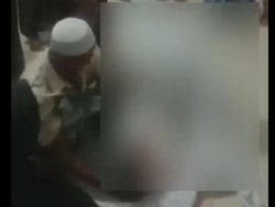 Kronologi Pasien COVID-19 yang Diviralkan Berdarah dengan Bola Mata Tak Ada