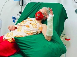 Tangan Patah saat Baca Hasil Pemilu AS, Rose McGowan Keluhkan Biaya RS