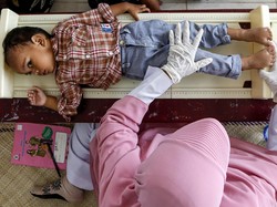 Kasus Polio Kembali Muncul di Indonesia, Apa Penyebabnya?