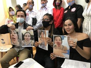 Fakta Baru Kasus Penganiayaan Isa Zega yang Tuding Nikita Mirzani Pelaku Fakta Baru Kasus Penganiayaan Isa Zega yang Tuding Nikita Mirzani Pelaku