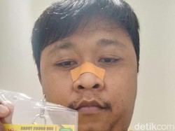 Sempat Jadi Relawan di Wisma Atlet, Perawat Situbondo Meninggal Karena COVID-19