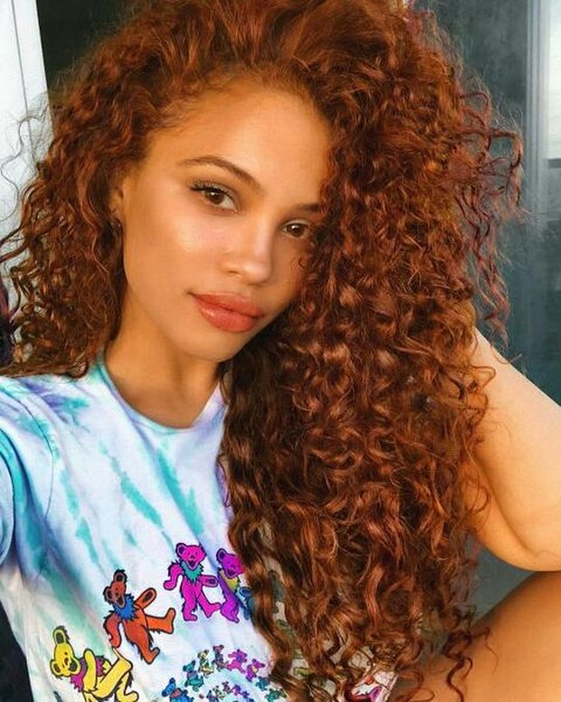 Kulit gelap cenderung memiliki banyak rona kulit hangat sehingga akan menonjol dari biasanya.