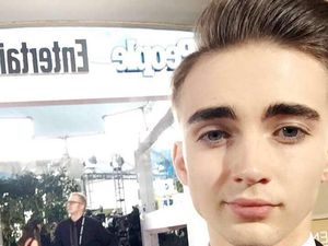 Pria Ini Habiskan Rp 1 M untuk Oplas, Implan Bisep Hingga Tanam Rambut