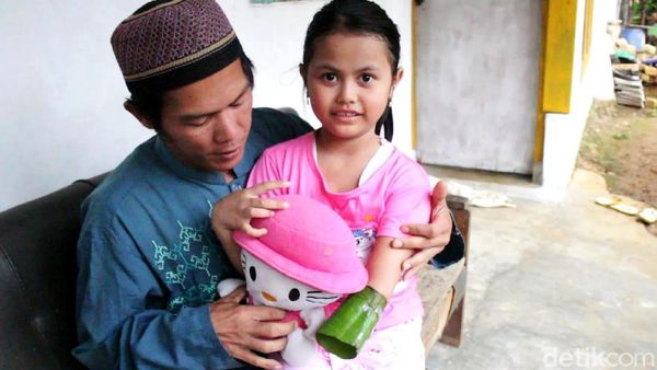 Anak Guru Ngaji di Sukabumi Ini Rela Menabung Demi Tangan Palsu