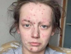 Viral, Before-After Wanita Mantan Pecandu Narkoba yang Bikin Pangling