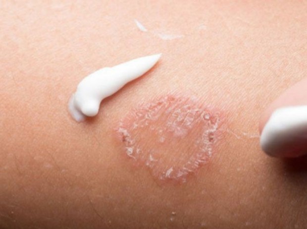 Dampak memakai celana dalam basah