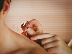 Akupuntur Sendiri di Rumah, Ini Caranya