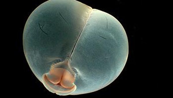 Foto: Cacing Unik Bernama Pantat Babi