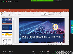 Manfaat Kecerdasan Buatan Bagi Profesi Radiografer
