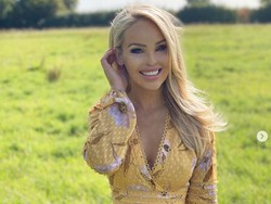 Jalani Operasi 400 kali, Katie Piper: Ini Adalah Anugerah Aku Masih Hidup