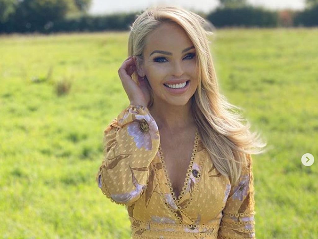 Jalani Operasi 400 kali, Katie Piper: Ini Adalah Anugerah Aku Masih Hidup Jalani Operasi 400 kali, Katie Piper: Ini Adalah Anugerah Aku Masih Hidup