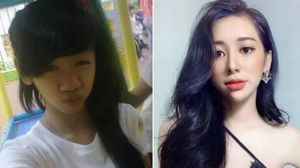 7 Potret Transformasi Wanita Usai Putus dan Lakukan Oplas, Beda Banget!