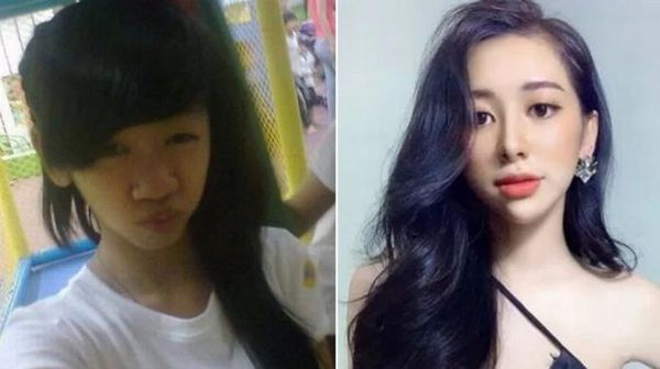 7 Potret Transformasi Wanita Usai Putus dan Lakukan Oplas, Beda Banget!