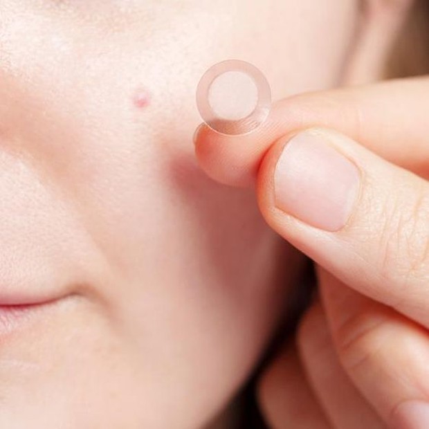 use pimple patch