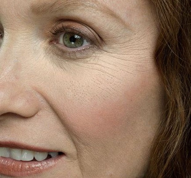 Manfaat hyaluronic acid dalam skincare