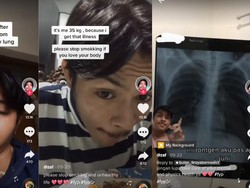 Kisah Viral Mantan Perokok, Berat Badan Turun 30 Kg karena Kena TBC