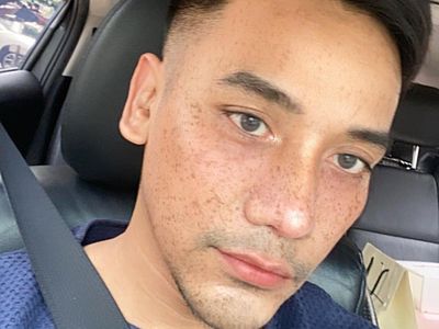 Foto: Penampilan Baru MUA Bubah Alfian Setelah Operasi Plastik Hidung
