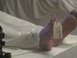 Dikira Sudah Meninggal, Seorang Pria Hidup Lagi Saat Akan Diformalin