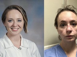 Viral Potret Before-After Nakes COVID-19, Wajah Penuh Luka Gara-gara APD