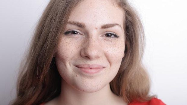 Mengatasi Bintik Hitam/ Foto: Pexels.com