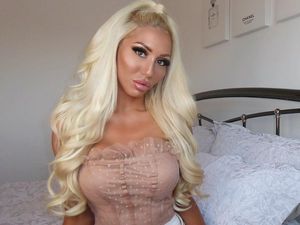 Foto: Wanita yang Berubah Total Jadi Mirip Barbie, Ini Penampilannya Dulu