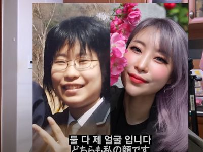 Foto Pemain Reply 1988 yang Oplas karena Dihujat Netizen, Terbaru Oplas Mata